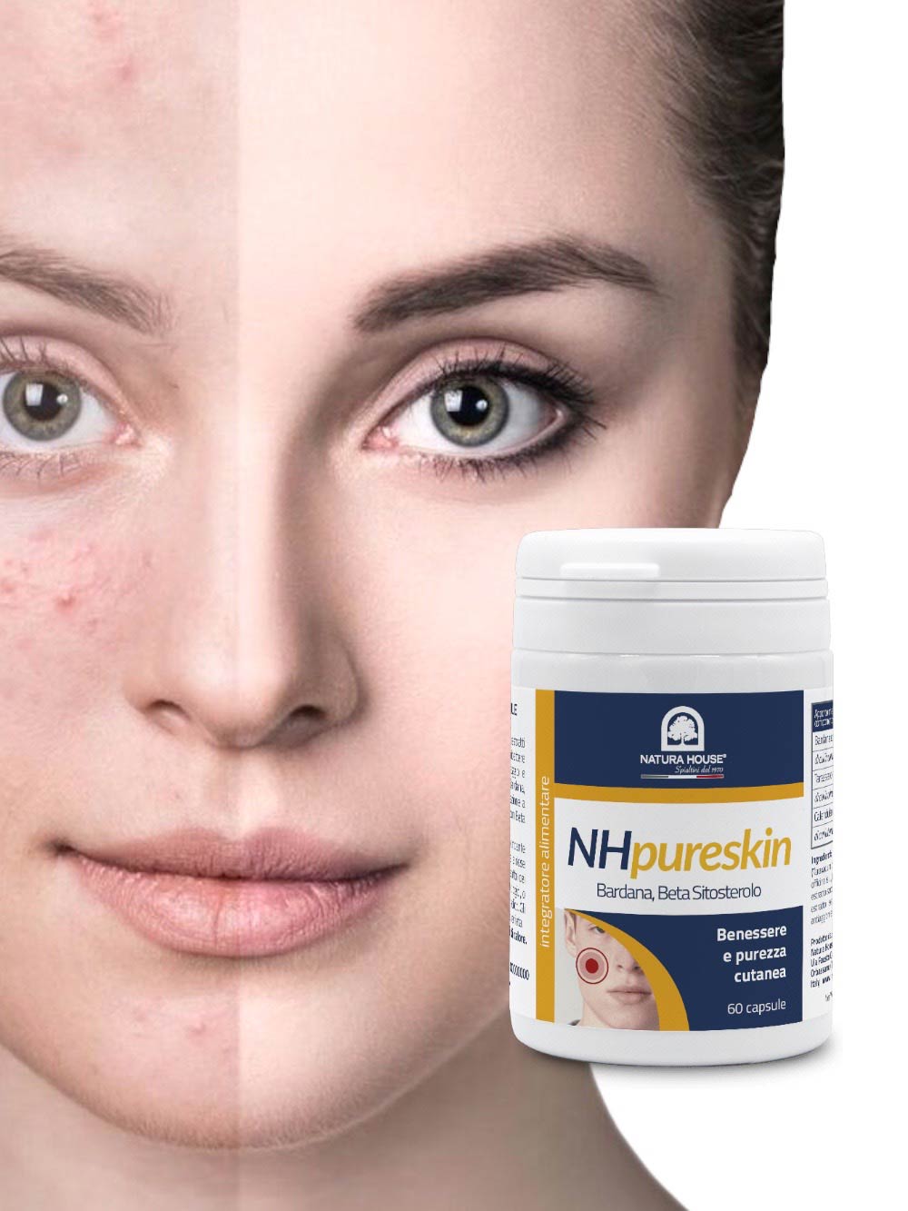 NH PURE SKIN Counteracts Sebum and Acne