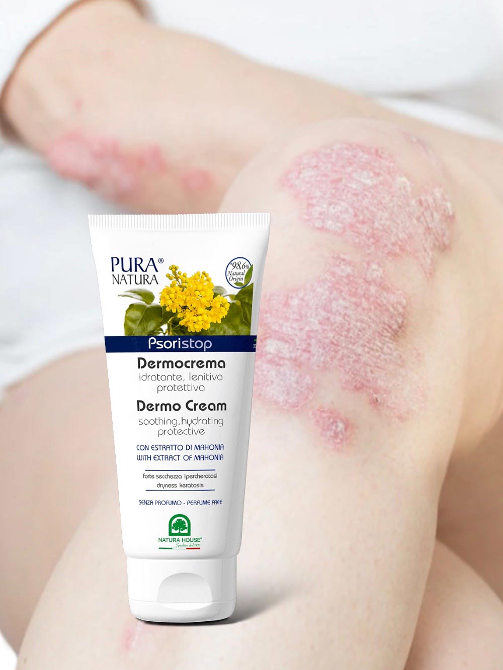 PSORISTOP DERMOCREMA Idratante Lenitiva Protettiva in caso di Psoriasi e Ipercheratosi